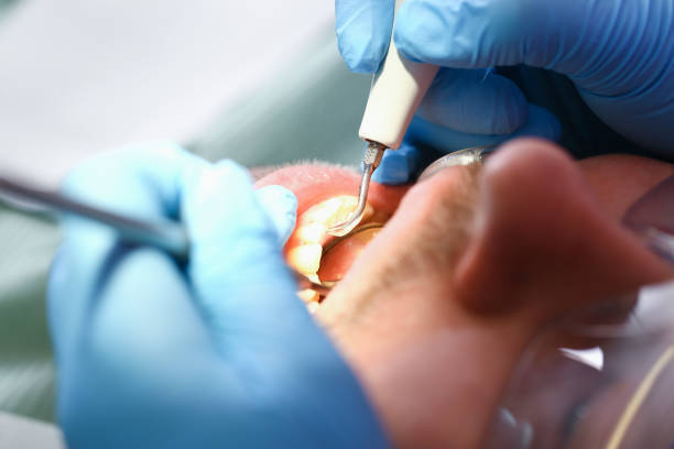 Best Emergency Treatment for Jaw Pain or Injury in Diberville, MS